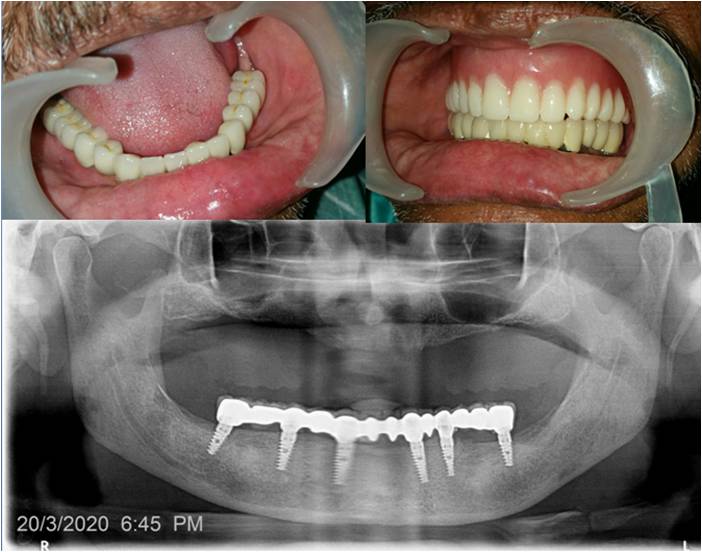 WhatsApp Image 2024-05-18 at 7.23.01 PM